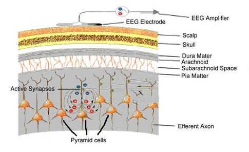 Electroencefalograma (1)
