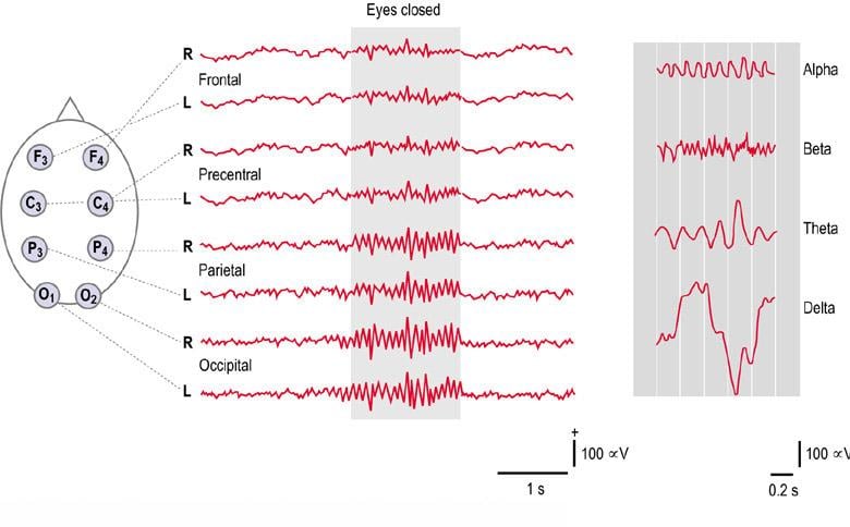 Electroencefalograma (1)